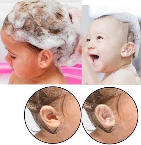 Su Geçirmez Yapışkanlı Kulak Koruyucu Bant 10 lu Paket (5430)