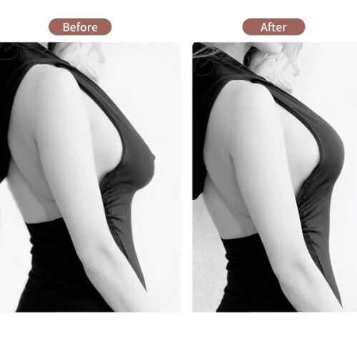 Göğüs Dikleştirme ve Şekillendirici Bant