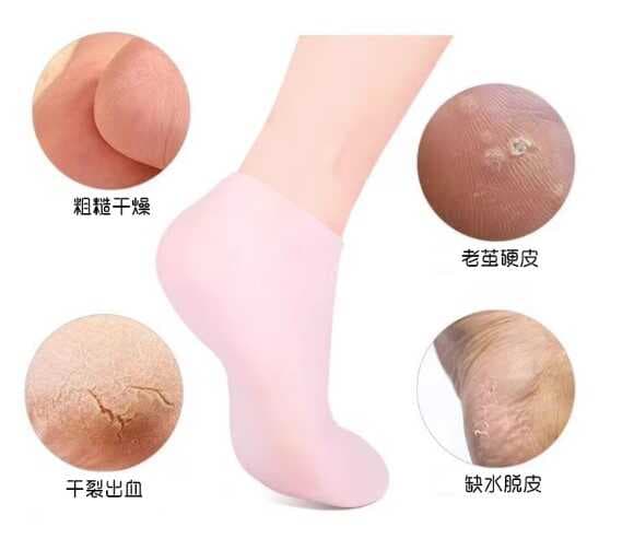 Silikon Nemlendirici Çorap Ayak Bakım Çorabı Pembe