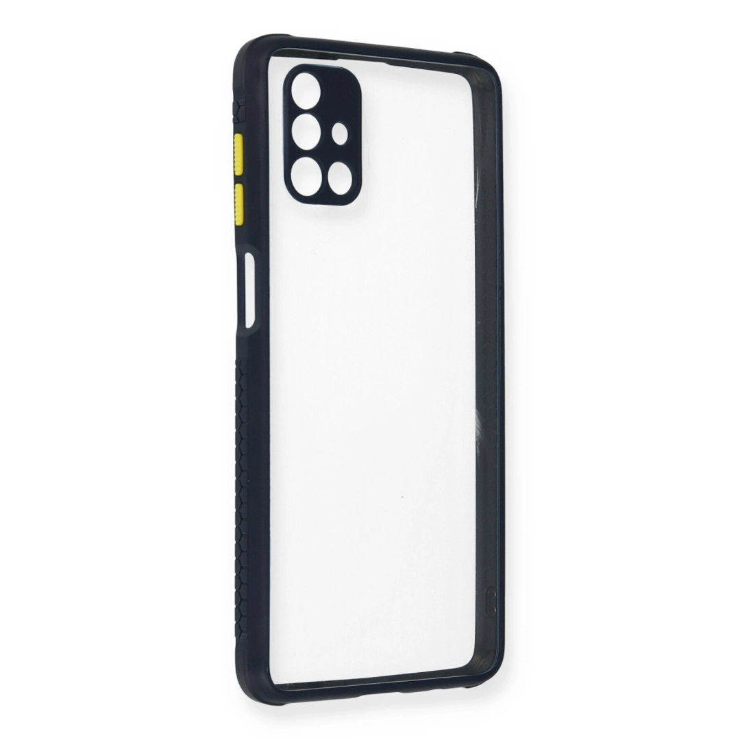 Samsung Galaxy M51 Kılıf Miami Şeffaf Silikon - Lacivert