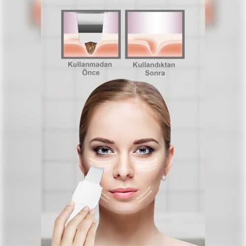 ULTRASONIC SİYAH NOKTA  AKNE SPATULA ŞARJLI CİLT TEMİZLEYİCİ