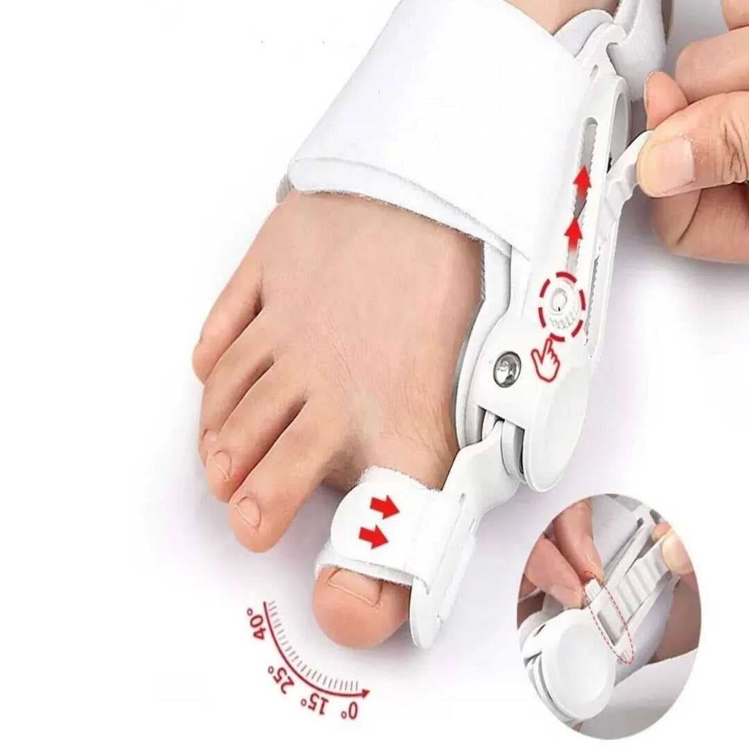 Ayarlanabilir Ayak Baş Parmak Kemik Düzeltici – Halluks Valgus (Bunyon) Aparatı, Gece Gündüz Kullanıma Uygun Ayak Düzeltme Ateli (5430)