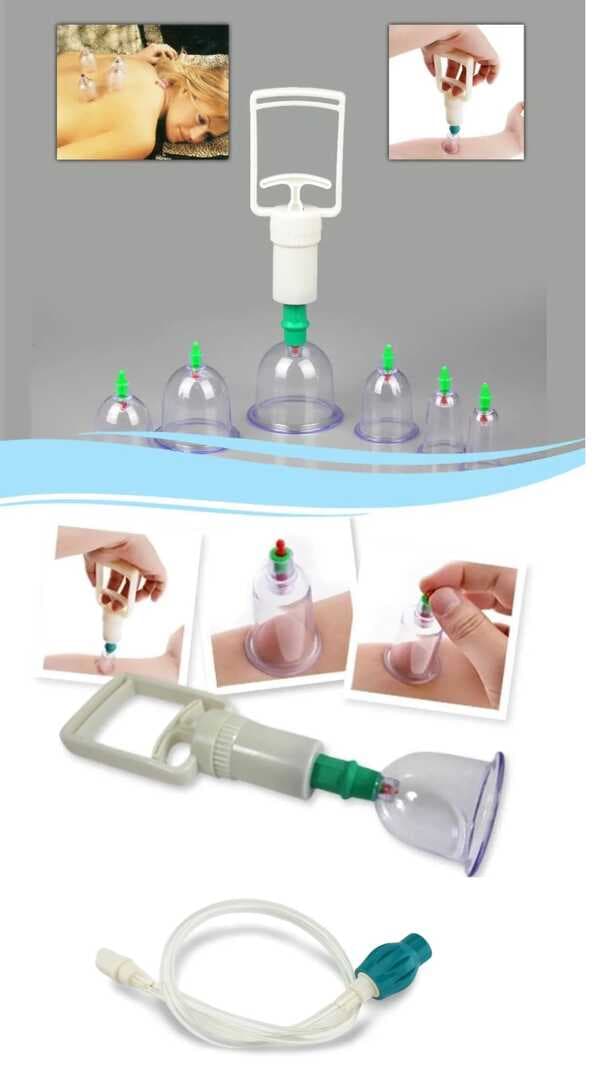 Hacamat Seti Hortumlu - Vakumlu Hortumlu Kupa Çekme Seti (Model 3) (477477)