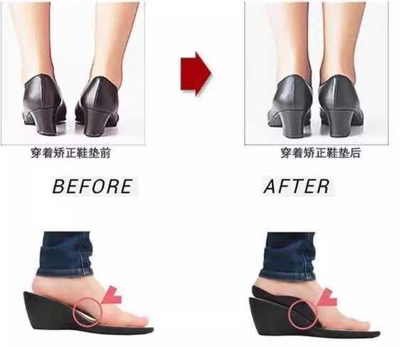 Nessiworld Esnek Düz Taban Düzeltici Topuk Yastığı